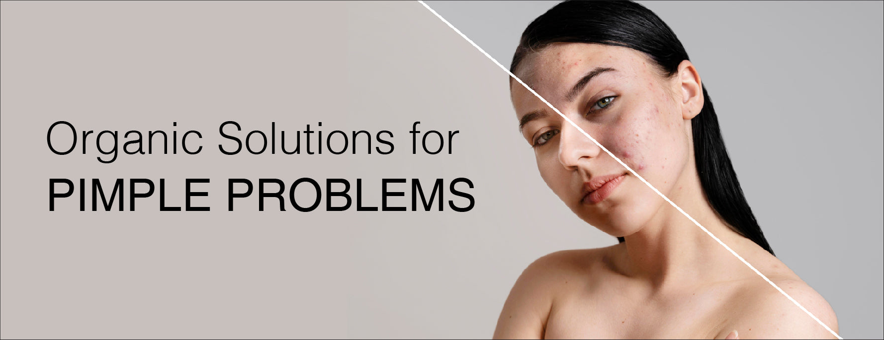 Organic Solutions for Pimple Problems: Nature's Remedies for Clearer S ...